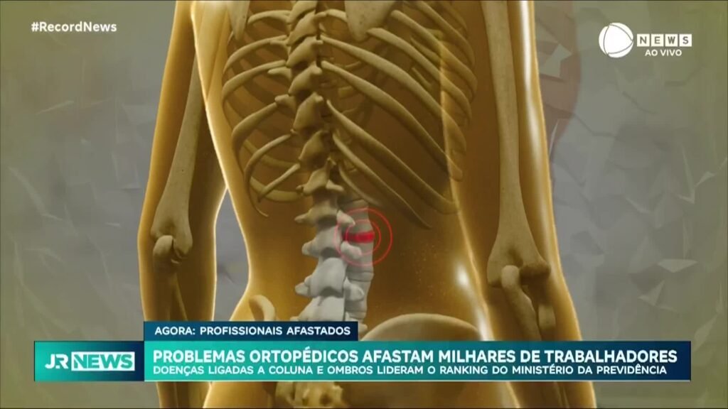 Doenas ligadas a coluna e ombros lideram ranking de afastamentos por problemas ortopdicos doenas-ligadas-a-coluna-e-ombros-lideram-ranking-de-afastamentos-por-problemas-ortopdicos