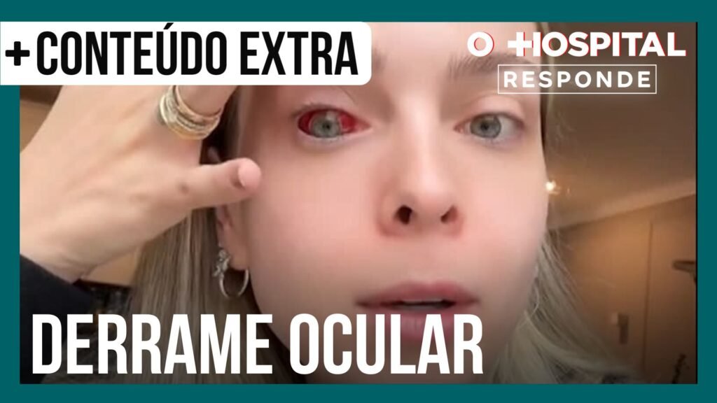 tata-estaniecki-sofre-derrame-ocular;-oftalmologista-explica-condio-|-o-hospital-responde