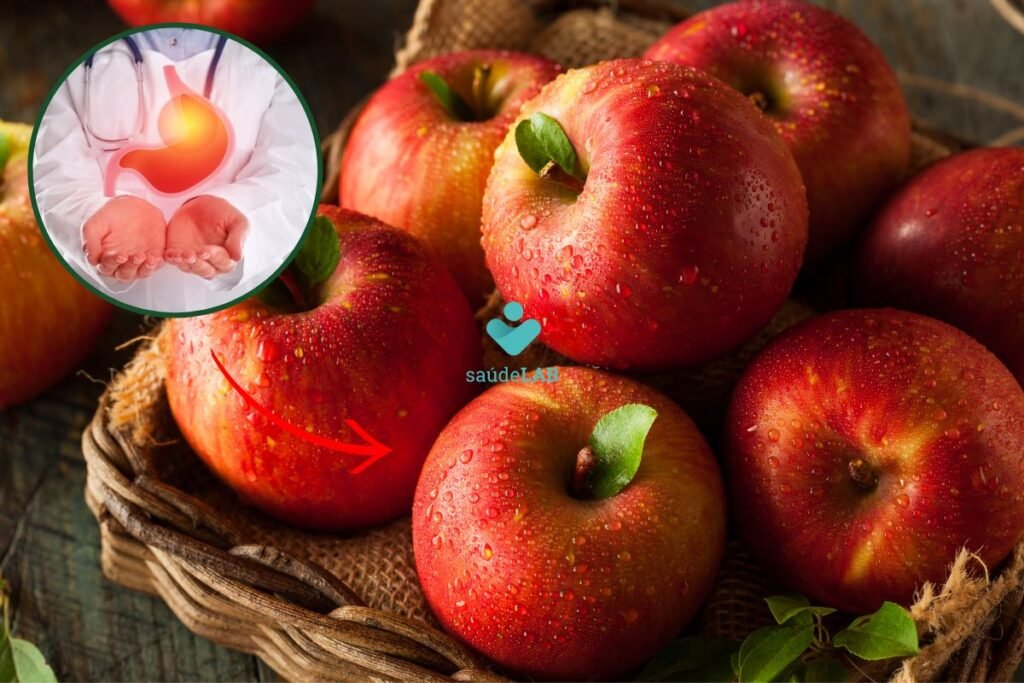 Quem tem gastrite pode comer ma? Entenda as nuances quem-tem-gastrite-pode-comer-ma?-entenda-as-nuances