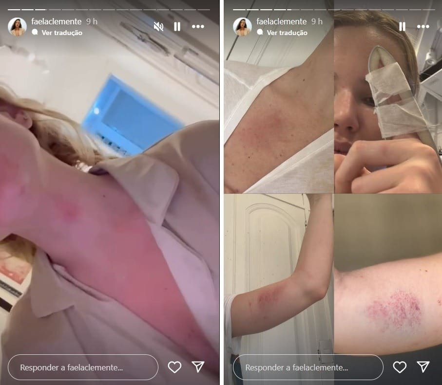 Marcela Tomaszewski denuncia agressões de Dado Dolabella e revela coação para negar violência